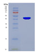 SDS-PAGE analysis of Human TNNC1 (Troponin C, Slow Skeletal And Cardiac Muscles) - Recombinant Protein, showing >90% purity under 15% SDS-PAGE (Reduced)