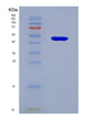 SDS-PAGE analysis of Human TNNC1 (Troponin C, Slow Skeletal And Cardiac Muscles) - Recombinant Protein, showing >95% purity under 15% SDS-PAGE (Reduced)