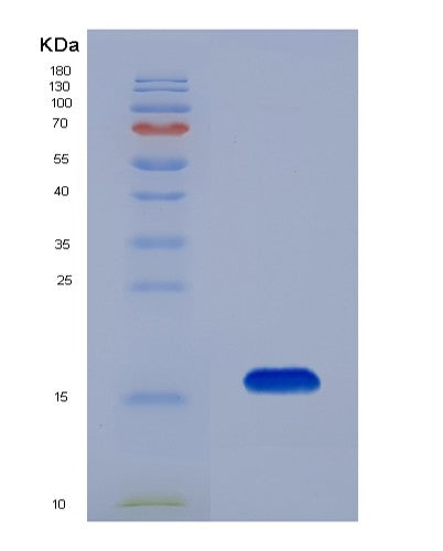 SDS-PAGE analysis of Human BTC (Probetacellulin) - Recombinant Protein, showing >85% purity under 15% SDS-PAGE (Reduced)