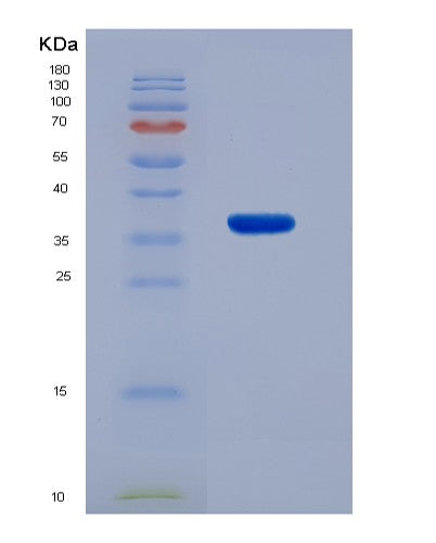 SDS-PAGE analysis of Human CA8 (Carbonic Anhydrase-Related Protein) - Recombinant Protein, showing >85% purity under 15% SDS-PAGE (Reduced)