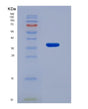 SDS-PAGE analysis of Human CA8 (Carbonic Anhydrase-Related Protein) - Recombinant Protein, showing >85% purity under 15% SDS-PAGE (Reduced)