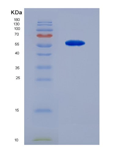 SDS-PAGE analysis of Human SPR (Sepiapterin Reductase) - Recombinant Protein, showing >90% purity under 15% SDS-PAGE (Reduced)