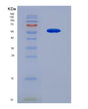 SDS-PAGE analysis of Human SPR (Sepiapterin Reductase) - Recombinant Protein, showing >90% purity under 15% SDS-PAGE (Reduced)