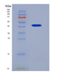 SDS-PAGE analysis of Human SAA4 (Serum Amyloid A-4 Protein) - Recombinant Protein, showing >85% purity under 15% SDS-PAGE (Reduced)