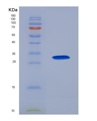 SDS-PAGE analysis of Human GCK (Hexokinase-4) - Recombinant Protein, showing >90% purity under 15% SDS-PAGE (Reduced)