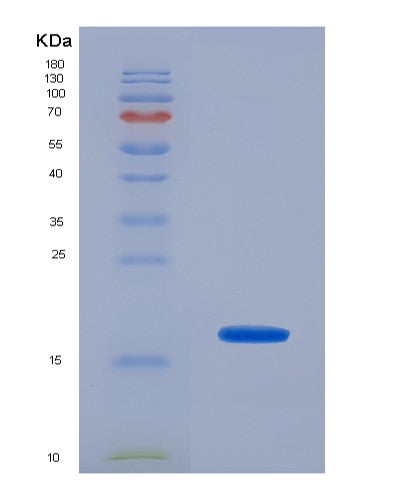 SDS-PAGE analysis of Human SELP (P-Selectin) - Recombinant Protein, showing >90% purity under 15% SDS-PAGE (Reduced)