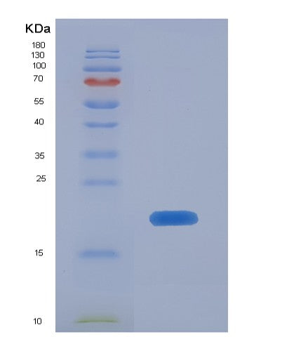 SDS-PAGE analysis of Human LTBR (Tumor Necrosis Factor Receptor Superfamily Member 3) - Recombinant Protein, CAT# BLT-08387P showing >85% purity under 15% SDS-PAGE (Reduced)
