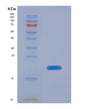 SDS-PAGE analysis of Human LTBR (Tumor Necrosis Factor Receptor Superfamily Member 3) - Recombinant Protein, CAT# BLT-08387P showing >85% purity under 15% SDS-PAGE (Reduced)