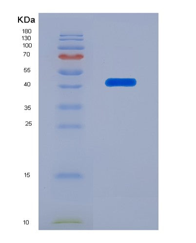 SDS-PAGE analysis of Human SERPINB5 (Serpin B5) - Recombinant Protein, showing >90% purity under 15% SDS-PAGE (Reduced)