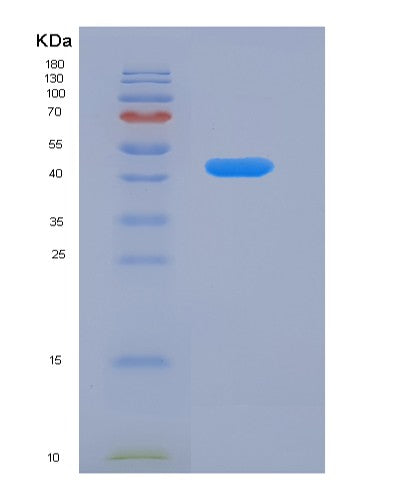SDS-PAGE analysis of Human SERPINF1 (Pigment Epithelium-Derived Factor) - Recombinant Protein, showing >95% purity under 15% SDS-PAGE (Reduced)