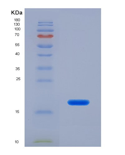 SDS-PAGE analysis of Human FDFT1 (Squalene Synthase) - Recombinant Protein, showing >95% purity under 15% SDS-PAGE (Reduced)