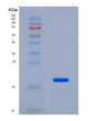 SDS-PAGE analysis of Human FDFT1 (Squalene Synthase) - Recombinant Protein, showing >95% purity under 15% SDS-PAGE (Reduced)