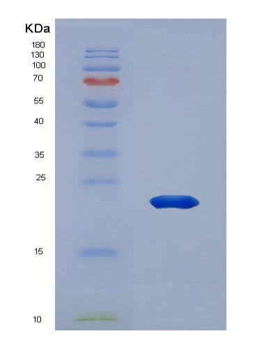SDS-PAGE analysis of Human ANP32A (Acidic Leucine-Rich Nuclear Phosphoprotein 32 Family Member A) - Recombinant Protein, showing >85% purity under 15% SDS-PAGE (Reduced)