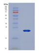 SDS-PAGE analysis of Human ANP32A (Acidic Leucine-Rich Nuclear Phosphoprotein 32 Family Member A) - Recombinant Protein, showing >85% purity under 15% SDS-PAGE (Reduced)