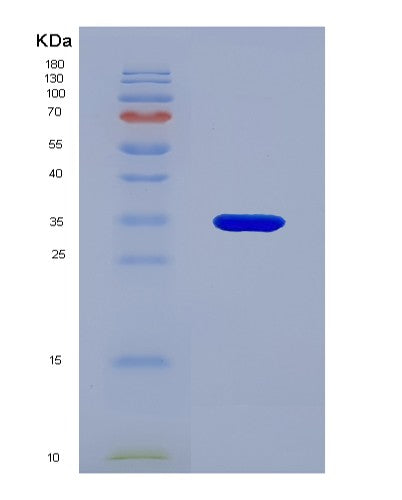 SDS-PAGE analysis of Human VHL (Von Hippel-Lindau Disease Tumor Suppressor) - Recombinant Protein, showing >85% purity under 15% SDS-PAGE (Reduced)