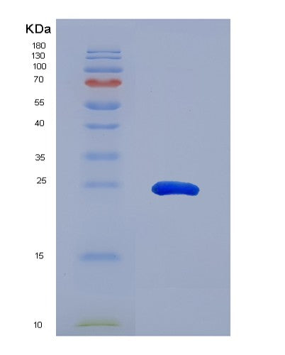 SDS-PAGE analysis of Human STAT3 (Signal Transducer And Activator Of Transcription 3) - Recombinant Protein, showing >95% purity under 15% SDS-PAGE (Reduced)