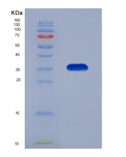 SDS-PAGE analysis of Human MDH2 (Malate Dehydrogenase, Mitochondrial) - Recombinant Protein, showing >90% purity under 15% SDS-PAGE (Reduced)