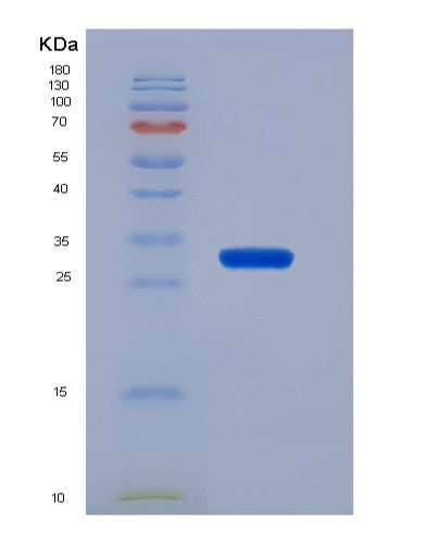 SDS-PAGE analysis of Mouse Klf4 (Krueppel-Like Factor 4) - Recombinant Protein, showing >90% purity under 15% SDS-PAGE (Reduced)