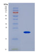 SDS-PAGE analysis of Human ECI1 (Enoyl-Coa Delta Isomerase 1, Mitochondrial) - Recombinant Protein, showing >95% purity under 15% SDS-PAGE (Reduced)