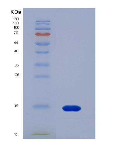 SDS-PAGE analysis of Human CASP2 (Caspase-2) - Recombinant Protein, showing >90% purity under 15% SDS-PAGE (Reduced)
