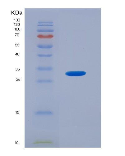 SDS-PAGE analysis of Human PDPK1 (3-Phosphoinositide-Dependent Protein Kinase 1) - Recombinant Protein, showing >90% purity under 15% SDS-PAGE (Reduced)