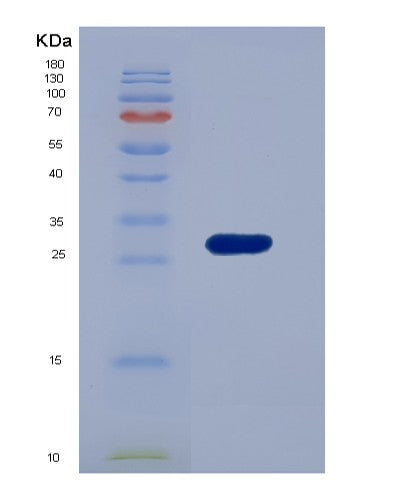 SDS-PAGE analysis of Human ADAM10 (Disintegrin And Metalloproteinase Domain-Containing Protein 10) - Recombinant Protein, showing >90% purity under 15% SDS-PAGE (Reduced)