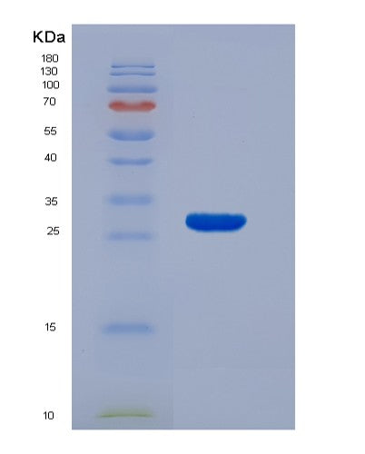 SDS-PAGE analysis of Human ADAM17 (Disintegrin And Metalloproteinase Domain-Containing Protein 17) - Recombinant Protein, showing >90% purity under 15% SDS-PAGE (Reduced)