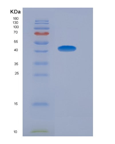 SDS-PAGE analysis of Human ADIPOR1 (Adiponectin Receptor Protein 1) - Recombinant Protein, showing >90% purity under 15% SDS-PAGE (Reduced)