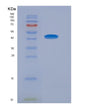 SDS-PAGE analysis of Human ADIPOR1 (Adiponectin Receptor Protein 1) - Recombinant Protein, showing >90% purity under 15% SDS-PAGE (Reduced)