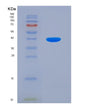 SDS-PAGE analysis of Mouse Adrb2 (Beta-2 Adrenergic Receptor) - Recombinant Protein, showing >90% purity under 15% SDS-PAGE (Reduced)