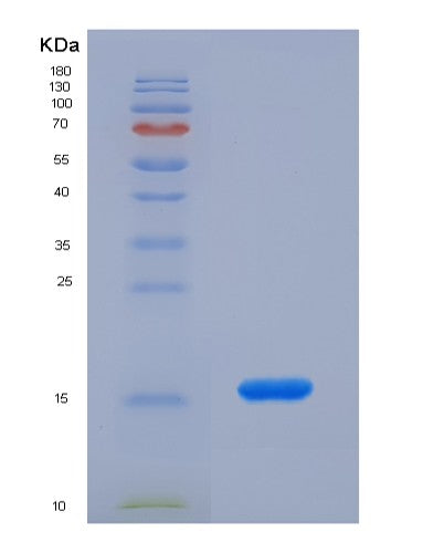 SDS-PAGE analysis of Mouse Lipe (Hormone-Sensitive Lipase) - Recombinant Protein, showing >90% purity under 15% SDS-PAGE (Reduced)