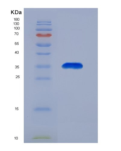 SDS-PAGE analysis of Human ACAA2 (3-Ketoacyl-Coa Thiolase, Mitochondrial) - Recombinant Protein, showing >90% purity under 15% SDS-PAGE (Reduced)