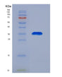 SDS-PAGE analysis of Human ACAA2 (3-Ketoacyl-Coa Thiolase, Mitochondrial) - Recombinant Protein, showing >90% purity under 15% SDS-PAGE (Reduced)