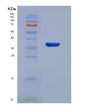 SDS-PAGE analysis of Human CXCL5 (C-X-C Motif Chemokine 5) - Recombinant Protein, showing >90% purity under 15% SDS-PAGE (Reduced)
