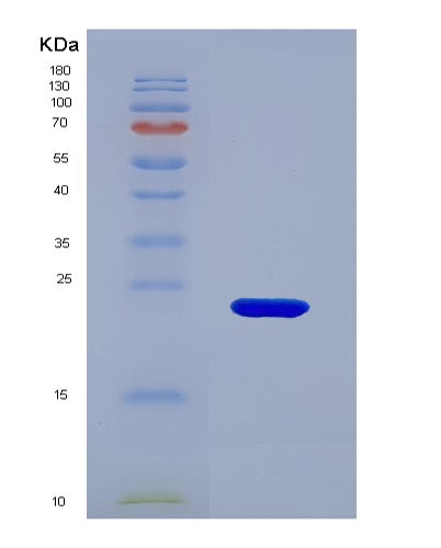 SDS-PAGE analysis of Human ALDH1A3 (Retinaldehyde Dehydrogenase 3) - Recombinant Protein, showing >90% purity under 15% SDS-PAGE (Reduced)