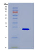 SDS-PAGE analysis of Human ALDH1A3 (Retinaldehyde Dehydrogenase 3) - Recombinant Protein, showing >90% purity under 15% SDS-PAGE (Reduced)
