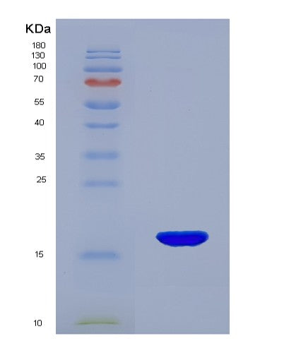 SDS-PAGE analysis of Mouse Rnase2 (Non-Secretory Ribonuclease) - Recombinant Protein, showing >90% purity under 15% SDS-PAGE (Reduced)