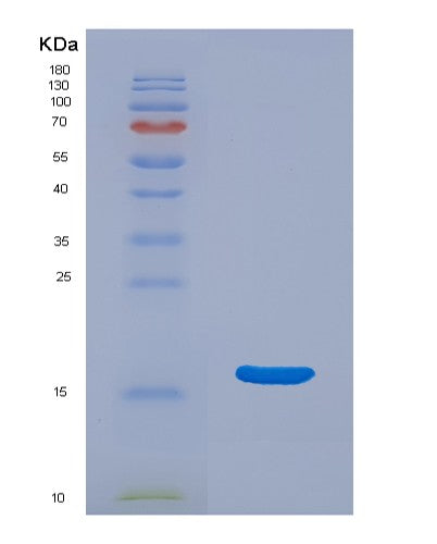 SDS-PAGE analysis of Mouse Ear3 (Eosinophil Cationic-Type Ribonuclease 3) - Recombinant Protein, showing >90% purity under 15% SDS-PAGE (Reduced)