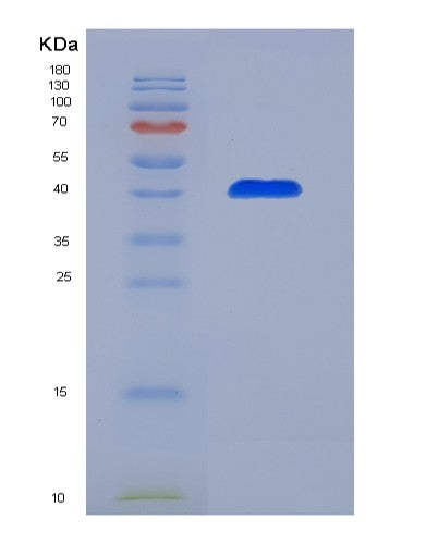 SDS-PAGE analysis of Mouse Vtn (Vitronectin) - Recombinant Protein, showing >90% purity under 15% SDS-PAGE (Reduced)