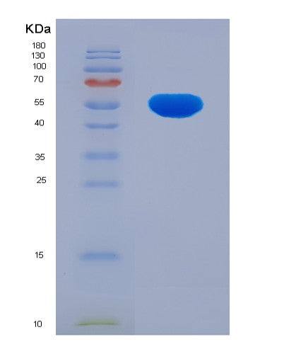 SDS-PAGE analysis of Human ALDH1B1 (Aldehyde Dehydrogenase X, Mitochondrial) - Recombinant Protein, showing >90% purity under 15% SDS-PAGE (Reduced)