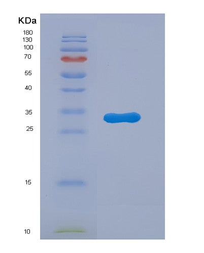 SDS-PAGE analysis of Mouse Ctss (Cathepsin S) - Recombinant Protein, showing >90% purity under 15% SDS-PAGE (Reduced)