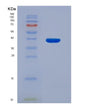 SDS-PAGE analysis of Human FARSB (Phenylalanine--Trna Ligase Beta Subunit) - Recombinant Protein, showing >90% purity under 15% SDS-PAGE (Reduced)