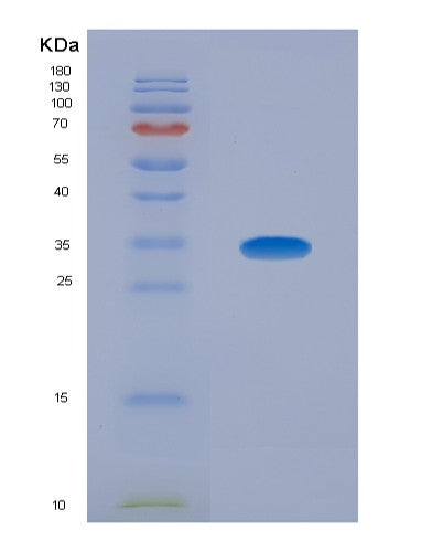 SDS-PAGE analysis of Human FARSA (Phenylalanine--Trna Ligase Alpha Subunit) - Recombinant Protein, showing >90% purity under 15% SDS-PAGE (Reduced)