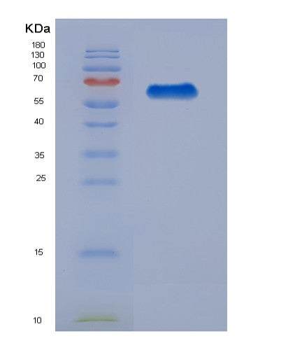 SDS-PAGE analysis of Human YARS1 (Tyrosine--Trna Ligase, Cytoplasmic) - Recombinant Protein, showing >90% purity under 15% SDS-PAGE (Reduced)