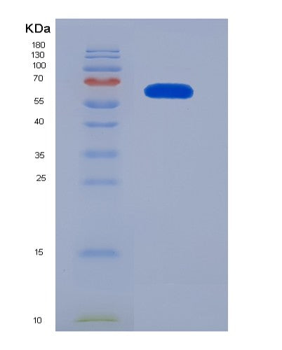 SDS-PAGE analysis of Human IARS1 (Isoleucine--Trna Ligase, Cytoplasmic) - Recombinant Protein, showing >90% purity under 15% SDS-PAGE (Reduced)