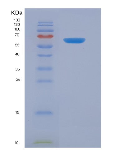 SDS-PAGE analysis of Human KIR3DL1 (Killer Cell Immunoglobulin-Like Receptor 3Dl1) - Recombinant Protein, showing >90% purity under 15% SDS-PAGE (Reduced)