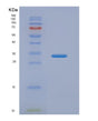 SDS-PAGE analysis of Human KIR2DS4 (Killer Cell Immunoglobulin-Like Receptor 2Ds4) - Recombinant Protein, showing >95% purity under 15% SDS-PAGE (Reduced)