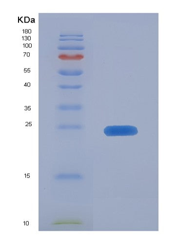 SDS-PAGE analysis of Human MMP13 (Collagenase 3) - Recombinant Protein, showing >90% purity under 15% SDS-PAGE (Reduced)