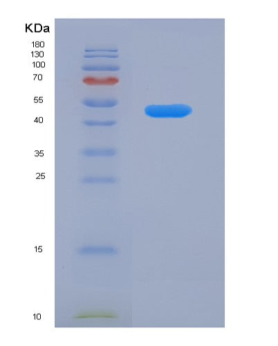 SDS-PAGE analysis of Human ACADSB (Short/Branched Chain Specific Acyl-Coa Dehydrogenase, Mitochondrial) - Recombinant Protein, showing >95% purity under 15% SDS-PAGE (Reduced)