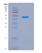 SDS-PAGE analysis of Human ACADSB (Short/Branched Chain Specific Acyl-Coa Dehydrogenase, Mitochondrial) - Recombinant Protein, showing >95% purity under 15% SDS-PAGE (Reduced)